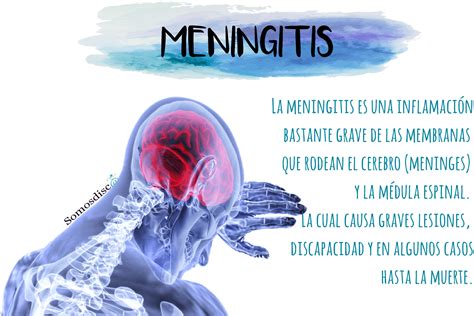 q es la meningitis